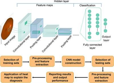 The application of artificial intelligence in glaucoma diagnosis and prediction